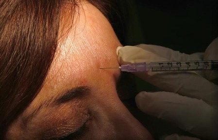 FDA approves cheaper Botox rival to treat frown lines