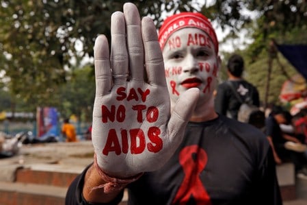 The Second Person Ever To Be Cured Of HIV: 