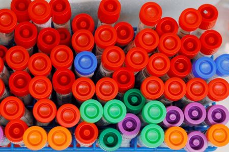 U.S. companies, labs rush to produce blood test for coronavirus immunity
