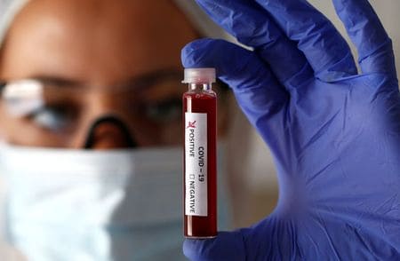 Healthcare group Novacyt steps up progress on coronavirus test product
