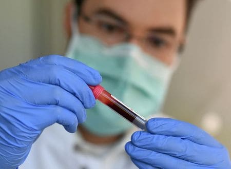 Germany’s coronavirus cases rise by 3,609 to 137,439: RKI