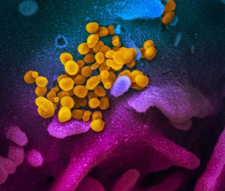 Sperm containing virus raises small risk of COVID-19 spread via sex: study