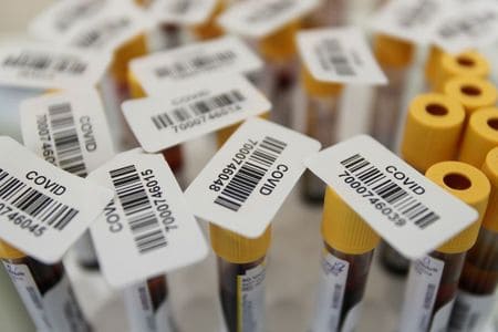 Moscow rolls out mass coronavirus antibody testing programme